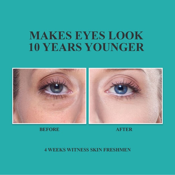 4/$100 🌱 Anti-Wrinkle Eye Cream Dark Circles Repair Wrinkle Hyaluronic Retinol - Picture 4 of 8